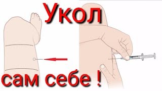 Как сделать себе удочку самому укол внутримышечно