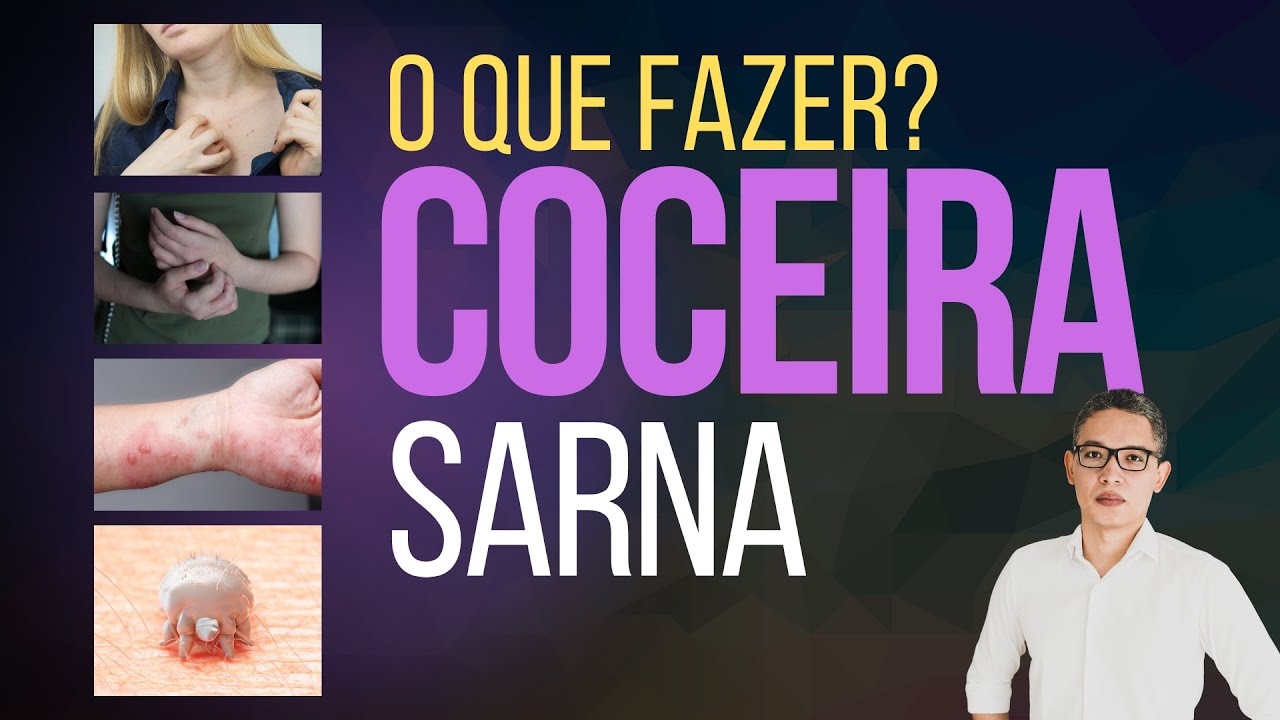COCEIRA NO CORPO PINICANDO | ALÍVIO IMEDIATO? SARNA? | Bicho e Remédio para Coceira no corpo