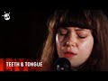 Teeth & Tongue cover The Smiths 'There Is A ...