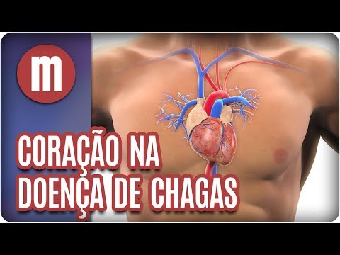 Bei chronischen Prostatitis leben lange Betrieb Prostata Zaporojie