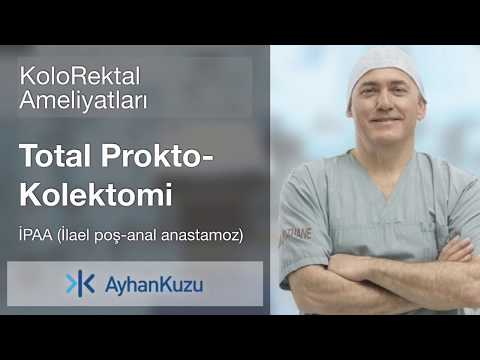 Kolorektal Ameliyatları #12 - Total Prokto Kolektomi İPAA