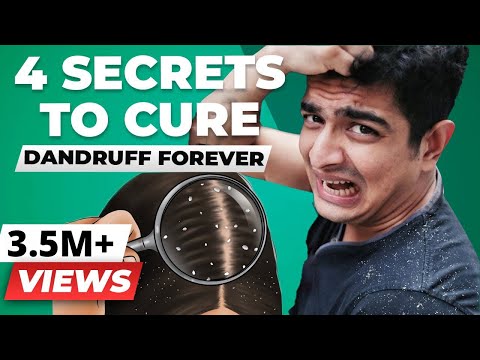 4 SECRET Tips To Remove Dandruff Forever | BeerBiceps...