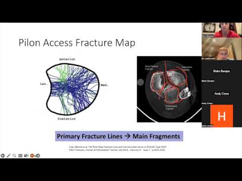 Principles of imaging in the pilon fracture