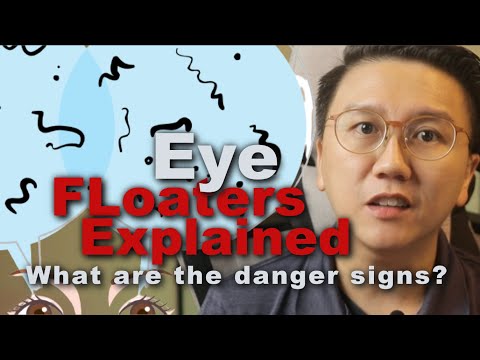 Eye Floaters Explained - Risks Causes and Symptoms