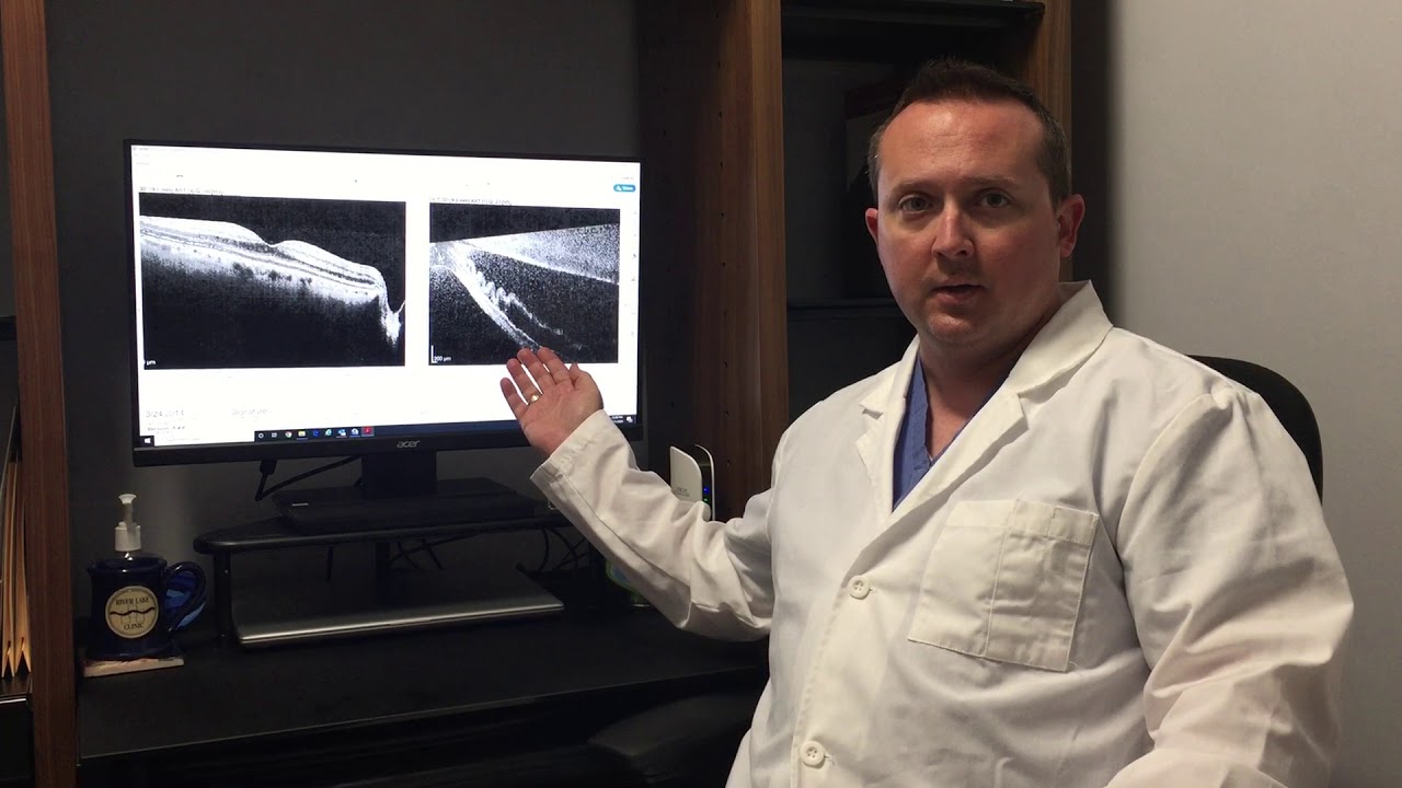 Dr. Josh Regarding Flashes and Floaters Needing Evaluation by Eye Doctor