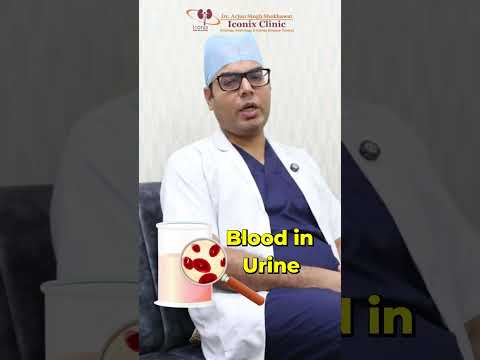 पथरी के कारण, बचाव के तरीके और असरदार घरेलू उपाय | Kidney Stone Treatment & Prevention