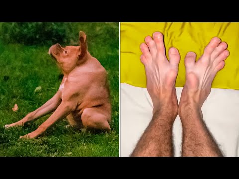 21 Уникальный Случай, Когда Ошибка Природы Сделала Кого-то Особенным