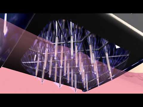 Morpheus 8 Skin Resurfacing