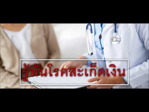 Tar ด้วยนมในโรคสะเก็ดเงิน ครีม akrustal ราคาแนะนำความคิดเห็น