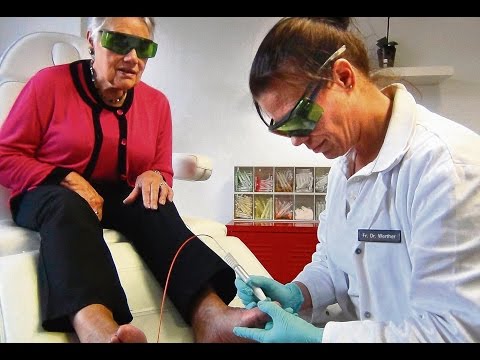 Das Mittel von gribka für slojaschtschichsja der Nägel Die Salbe von gribka auf dem Körper die braunen Flecke