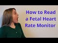 READING AND INTERPRETING A FETAL HEART RATE MONITOR