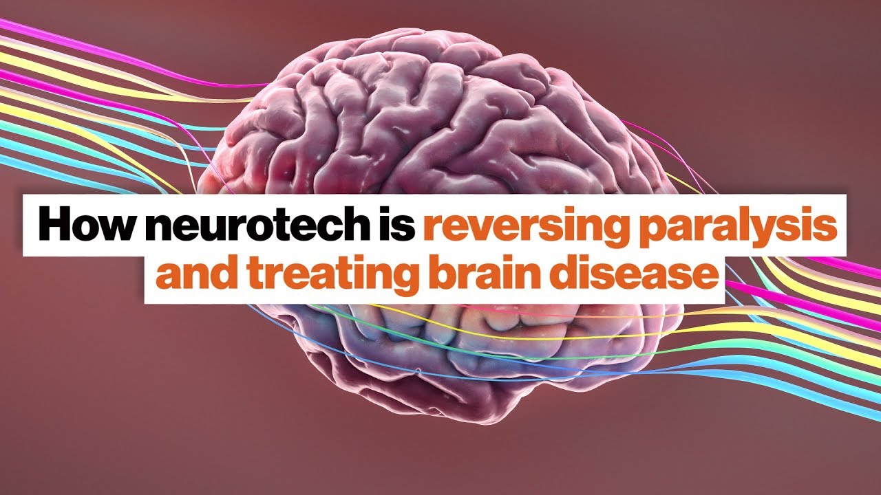 Neuroprosthetics and deep brain stimulation: Two big neuroscience breakthroughs | Susan Hockfield - YouTube