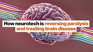 Neuroprosthetics and deep brain stimulation: Two big neuroscience breakthroughs | Susan Hockfield