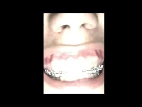 Adenaim - cold freestyle prod RUINS (Snippet)