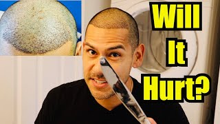Removing Hair Transplant Scabs With Butter Knife!