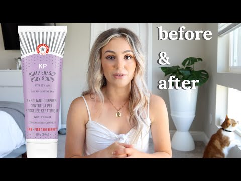 First Aid Beauty KP Bump Eraser Scrub- My HONEST Review