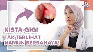 Download lagu DENTAL CYSTS ARE REAL!! IT TURNS OUT.... mp3 Download lagu DENTAL CYSTS ARE REAL!! IT TURNS OUT.... mp3
