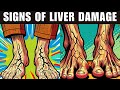 LIVER is DYING 12 Weird Signs of Liver Damage (There's No Denying It)