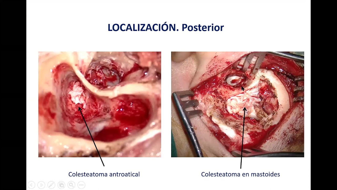 Rubén Polo López-16