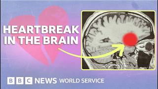 How love and heartbreak rewire your brain - BBC World Service