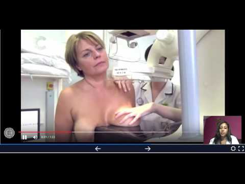 3 Grad der BPH Wo die weibliche Prostata