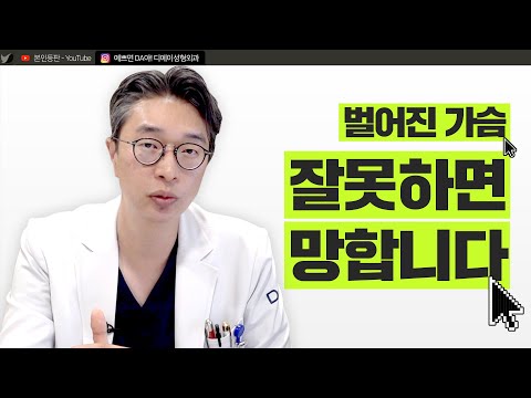벌어진 가슴도 가슴성형으로 이쁜 가슴골을 만들 수 있다?
