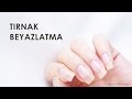 Evde Tırnak Nasıl Beyazlatılır?