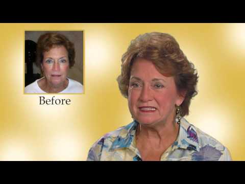 Laser Hair Therapy Worked for Joyce