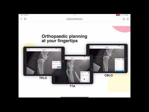 Como usar a ferramenta Anatomic Axis no vPOP pro!