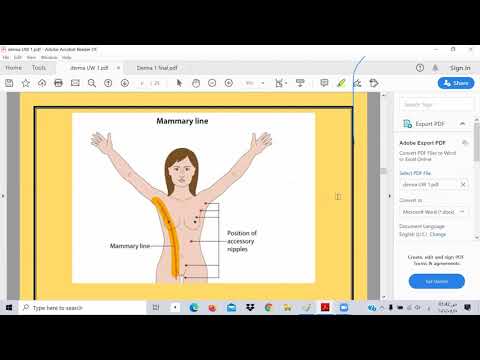 UW DERMA 1-TOXIC USMLE -IBRAHEM GAMAL-شرح وحل المعادلة الامريكية ابراهيم جمال