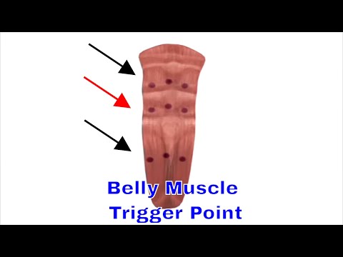 belly muscle trigger point