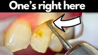 2 Expert Tips for PERFECT Restorations...