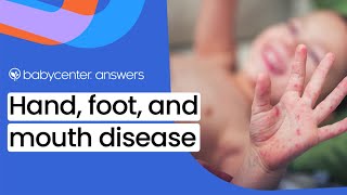 What is hand, foot, and mouth disease?