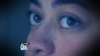 One Woman’s Corrective Bulging Eye Surgery