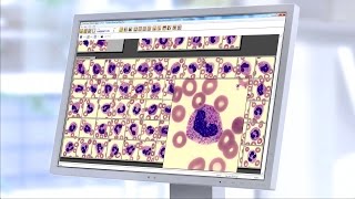 Introducing: CellaVisionu00ae Peripheral Blood Application