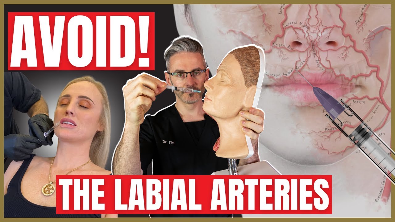 Lip Injection Techniques to Avoid the Arteries | Vertical or Horizontal?
