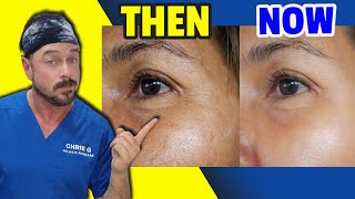 How To Reverse Skin Aging In Minutes | Chris Gibson
