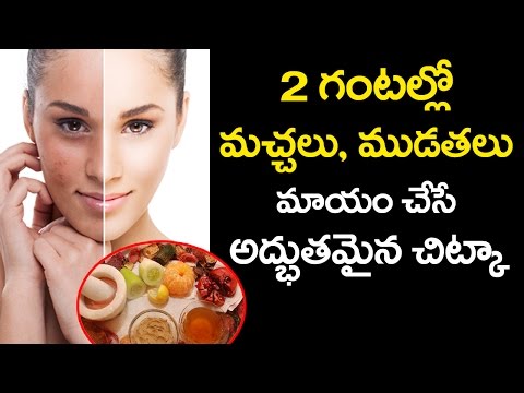 How to Reduce Pigmentation and Black Spots | Amazing Beauty Tips | VTube Telugu Video