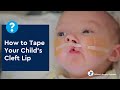 How To Tape Your Child S Cleft Lip