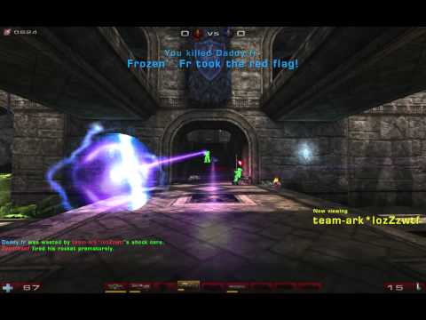 Lozzz Mega WTF vs French