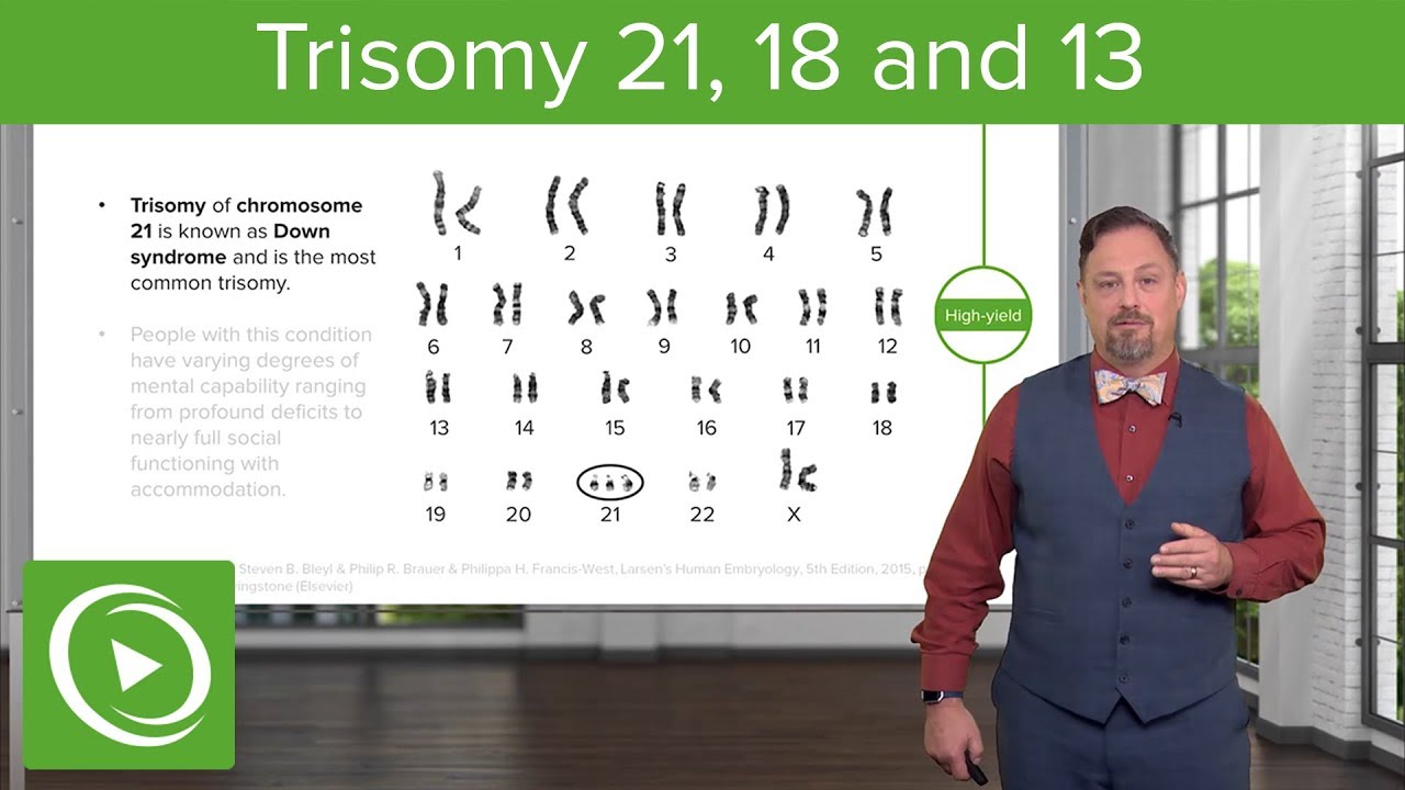 Chromosomal Abnormalities: Trisomy 21,18 & 13 – Embryology | Lecturio