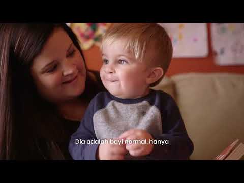 Dr. Brown's Specialty Feeding: Testimony of Cleft Lip