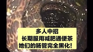 酵素，减肥通便茶，日本小粉丸请不要乱吃，你的肠子可能早都黑了