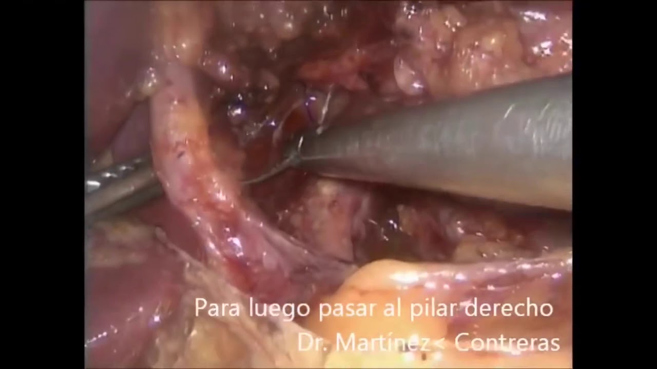 Arturo Martínez Contreras-12