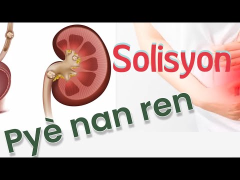 Pyè nan ren… ou calculs rénaux Prekosyon ak saw dwe fè  pou evitel