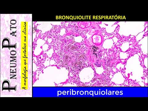 Minuto PneumoPato - Bronquiolite Respiratória