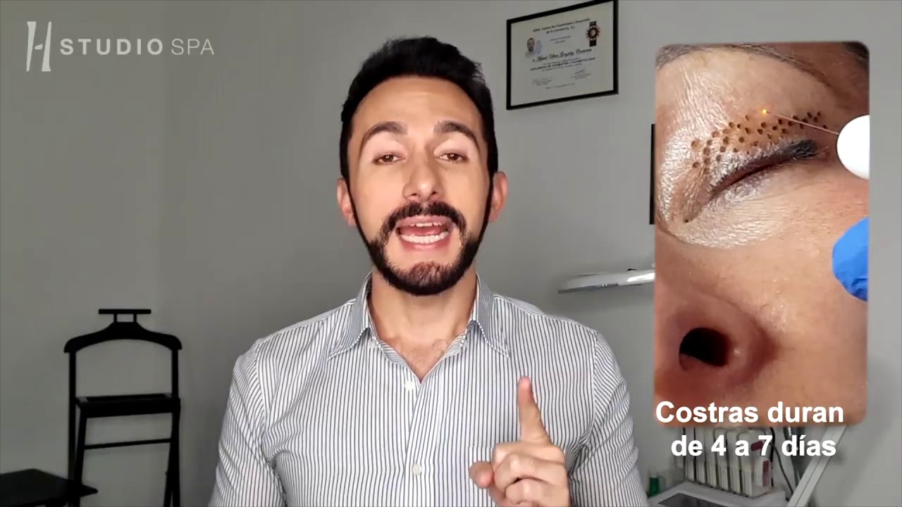 PLASMA PEN / ANTES Y DESPUES