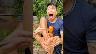 CCT - Tôi bị đau chân || I have a sore leg.