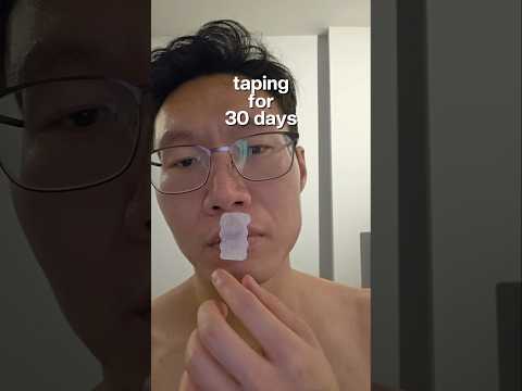 RESULTS: MOUTH TAPING for 30 days #mouthtape
