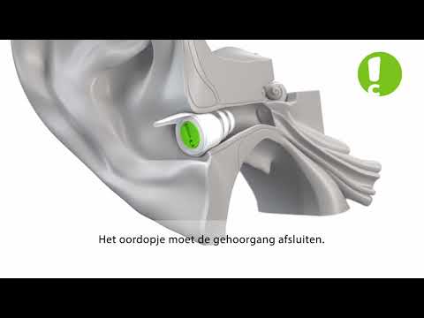 NL - How to insert earplugs - AudioNova hearing protection